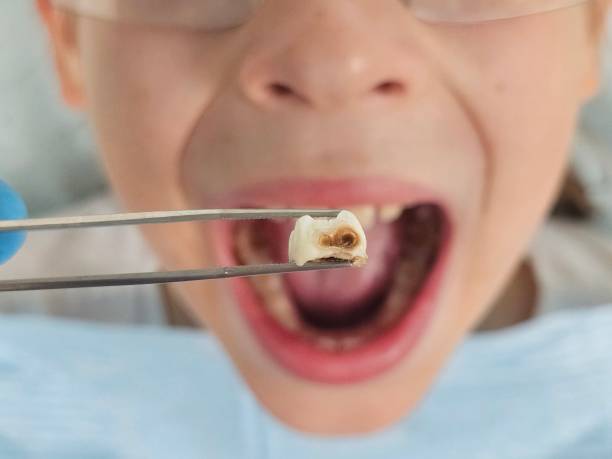 Best Emergency Dental Care for Trauma or Injury in New Madrid, MO